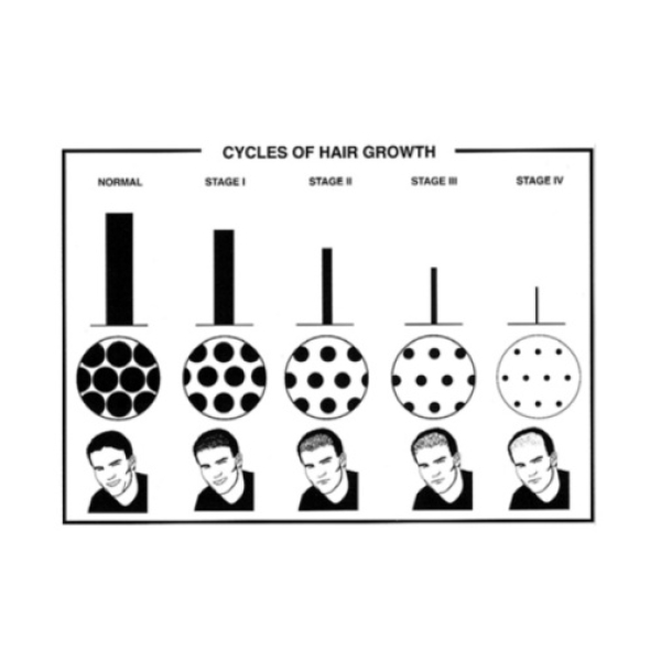7 Reasons UP Hair Growth Shampoo Gives You Thicker, Healthier Locks Fast