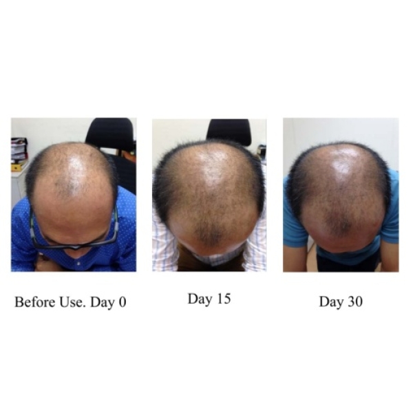 7 Reasons UP Hair Growth Shampoo Gives You Thicker, Healthier Locks Fast